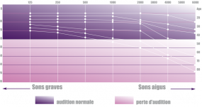 Presbyacousie